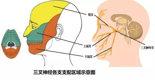 专家解密"天下第一痛"-------三叉神经痛!