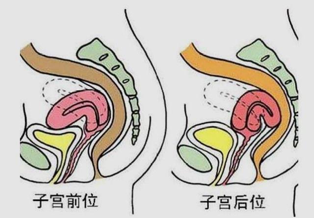 然后是女性手脚暖和,说明一般不是寒性体质,那么子宫也会比较温暖,也