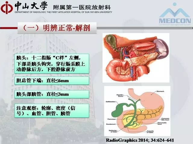 吐血推荐:胰头壶腹周围病变的影像诊断思路