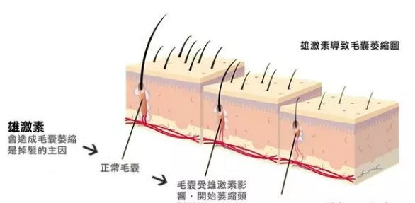 头发毛囊坏死怎么办