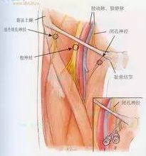 大腿两侧磨的疼怎么办