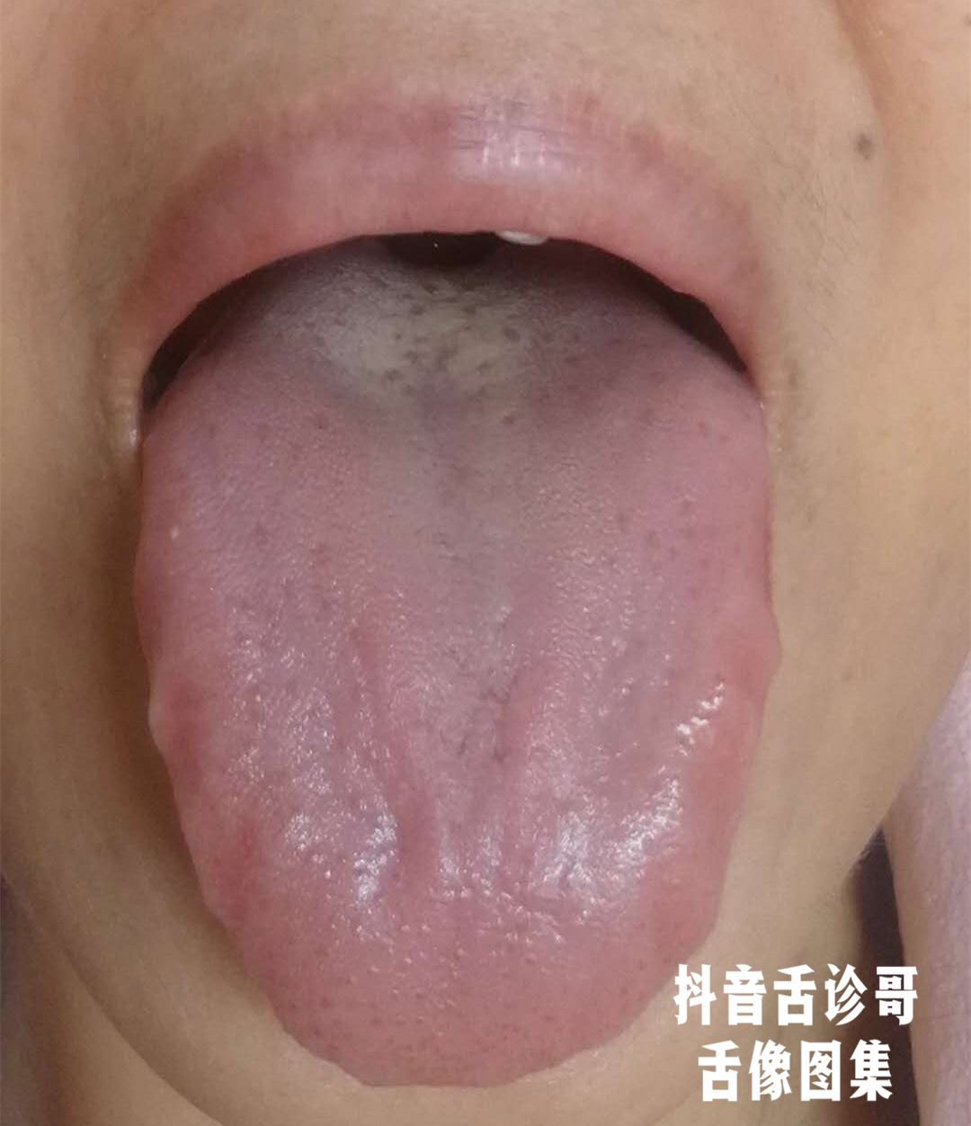 066eb6dd72b84b2e86e8b4f81d0207a9.jpeg