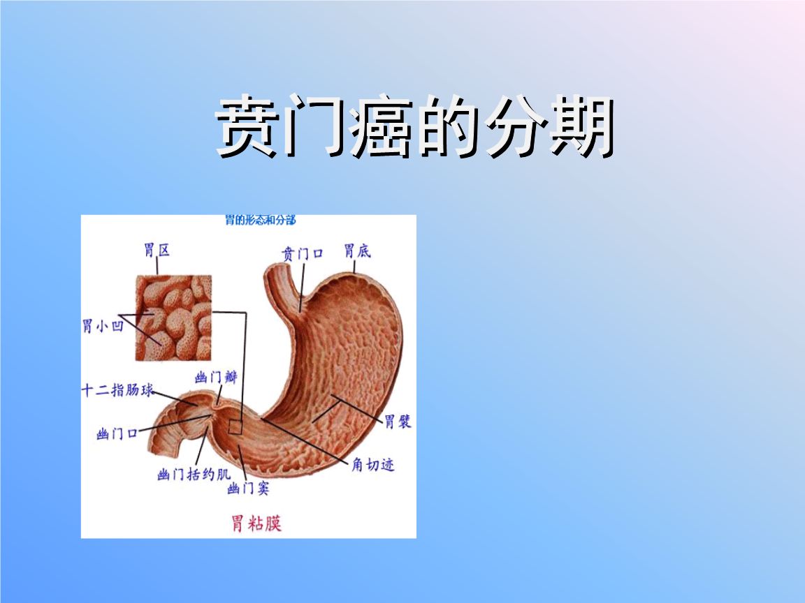 常见消化道恶性肿瘤之一,食道癌早期有5种表现