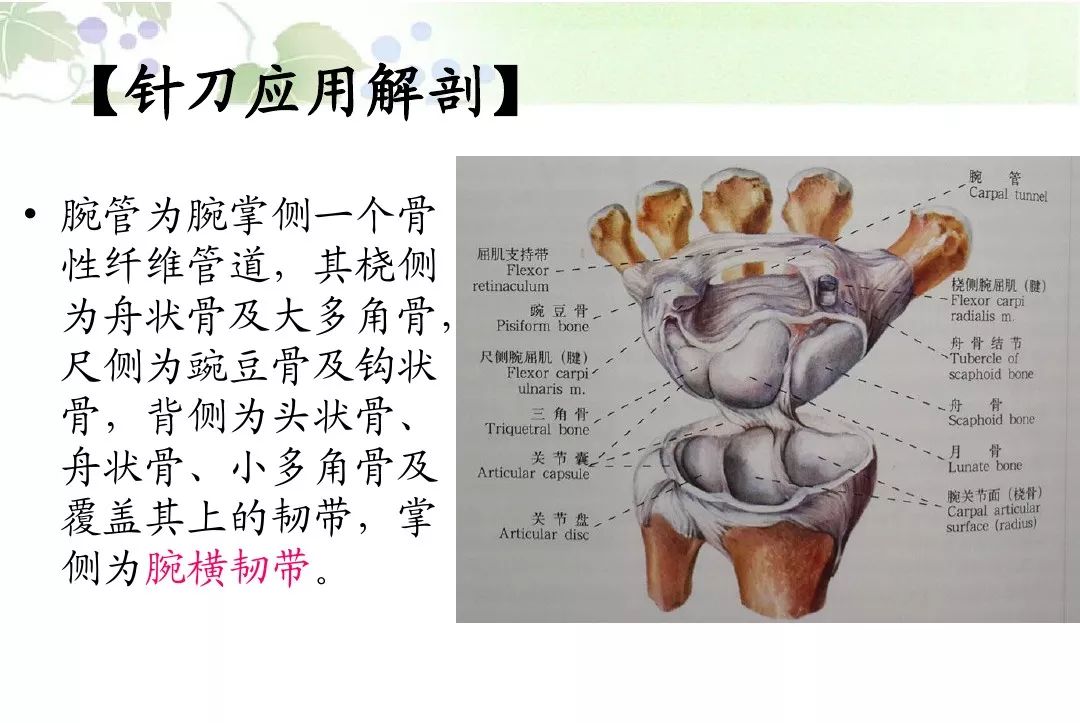 针刀治疗腕管综合征