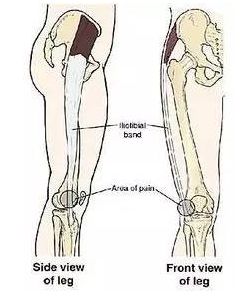 大腿两侧磨的疼怎么办