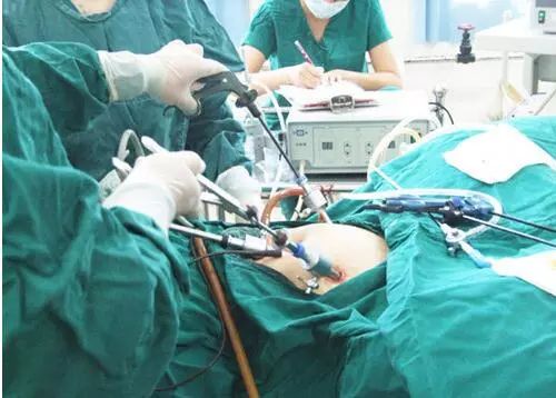 妇科腹腔镜术后护理_手机搜狐网