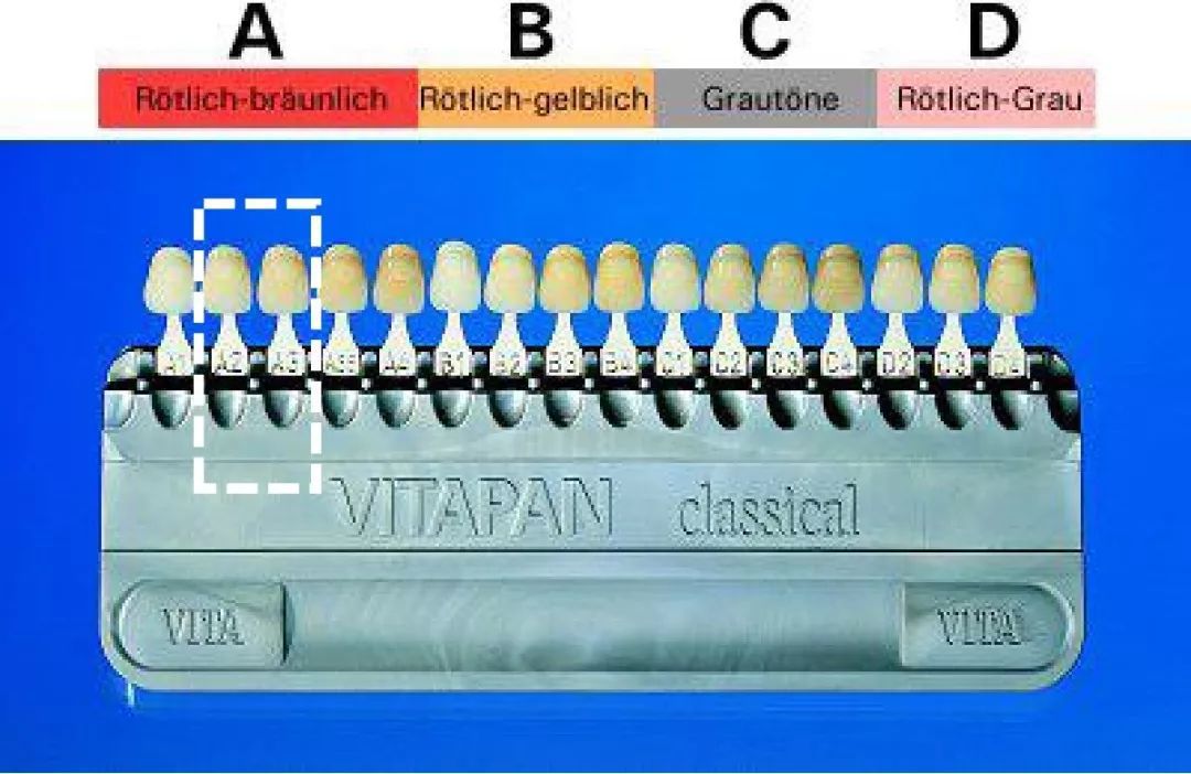 更适合东方人的牙齿颜色是在 vitapan classical 比色板上a2—a3左右