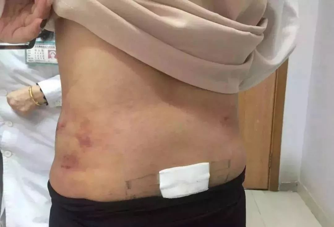 如何做手术变成女人 f9102e3654b143248c81890f8f7e0df6.jpeg