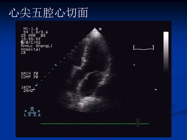 【超声微课堂】超声心动图基础知识和常用切面