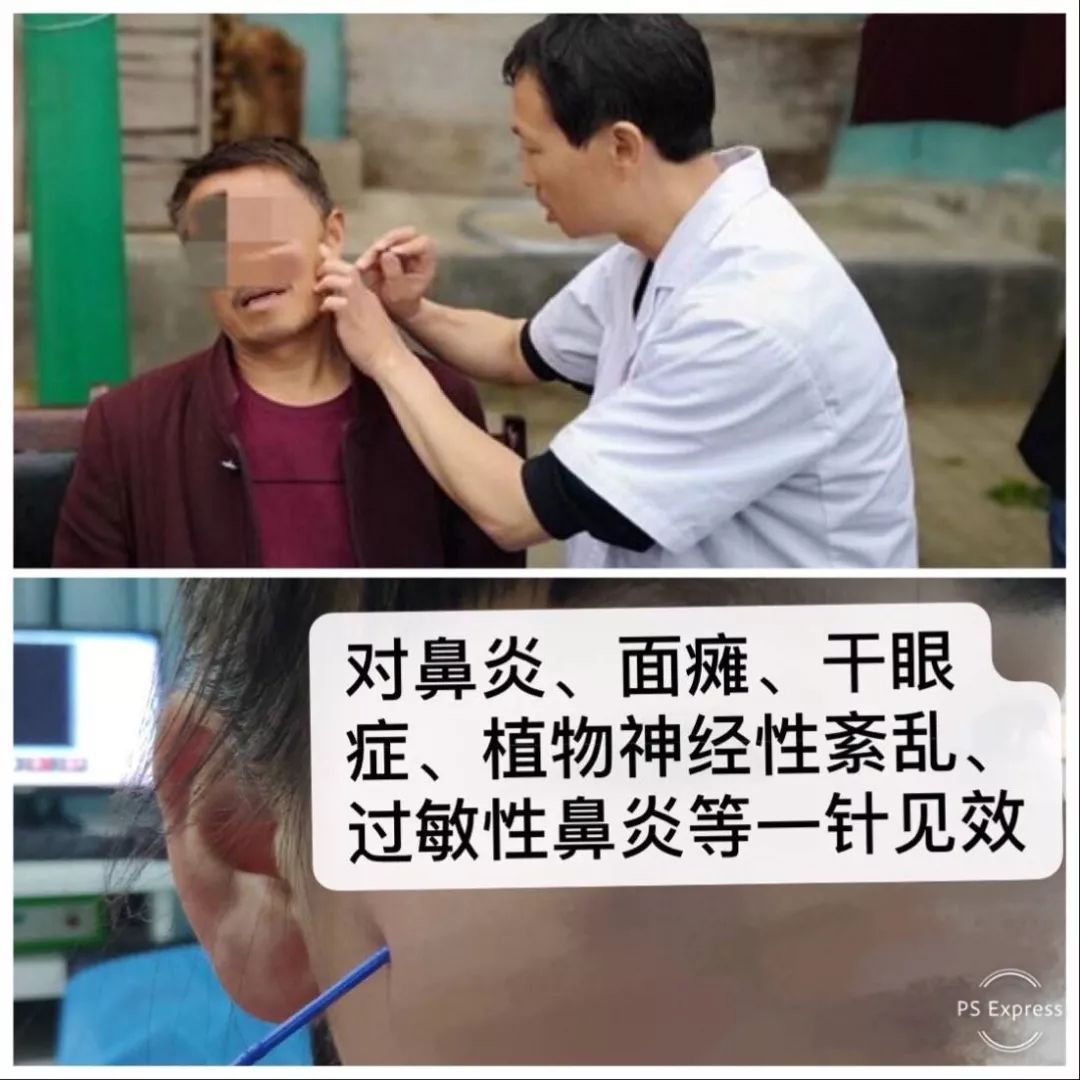 理疗及手术治疗扁桃体炎,腺样体肥大,慢性咽炎,耳鸣耳聋,过敏性鼻炎有
