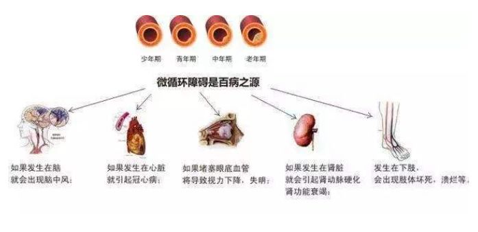 堵奶有硬块冷敷是什么原理_小腿有硬块是什么症状