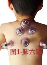 什么方法治咳嗽最快最好 ed0bb407c2fb461ab688b45e1be199a5.jpg