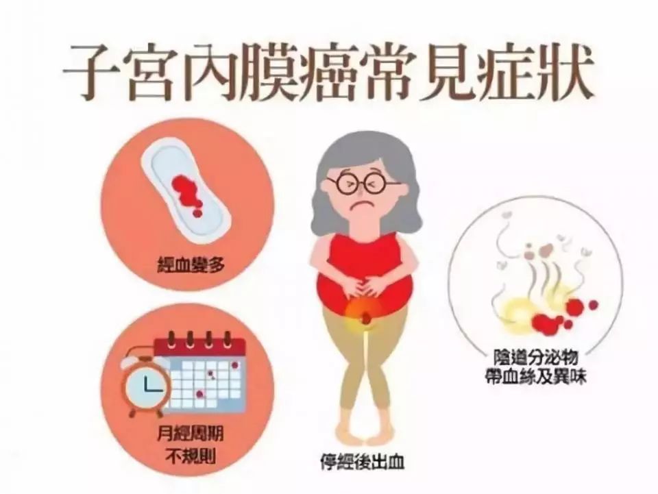 子宫内膜虽然是妇科三大恶性肿瘤之一,但其病因不十分清楚.