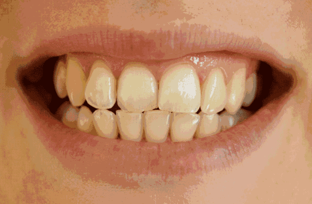 0be1a1779fb84bcf85ed7c0e759e8e0d.gif
