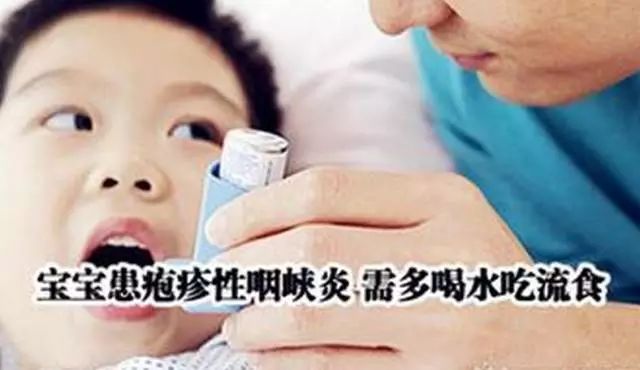                     幼儿园疱疹性咽峡炎进入高发期，这些防护知识家长要知道