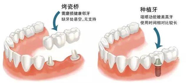 人口腔体积_人口腔上皮细胞图(3)