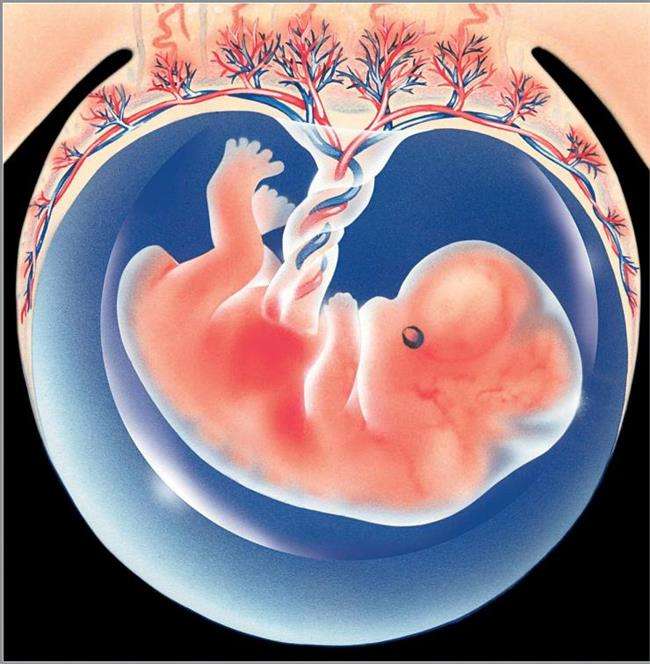 6个月胎儿在孕妇肚子里脐带断裂停止发育原因是它赶紧预防