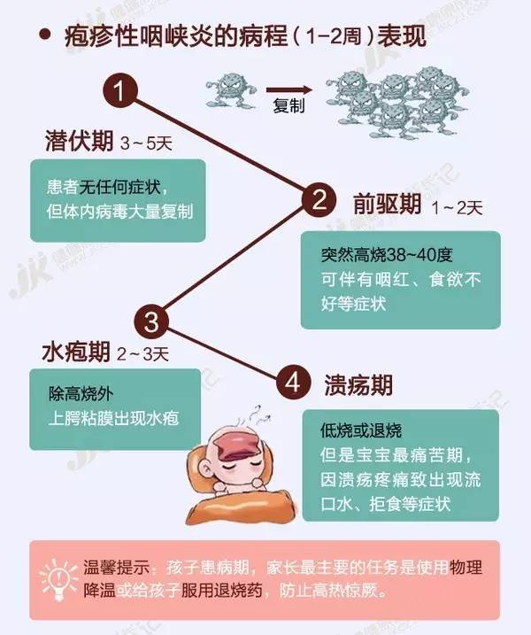                     幼儿园疱疹性咽峡炎进入高发期，这些防护知识家长要知道