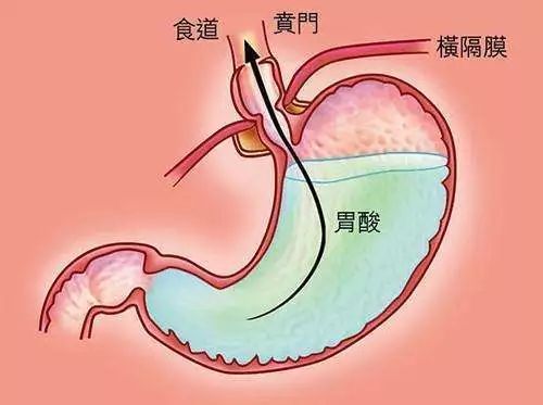 吃南瓜烧心怎么办