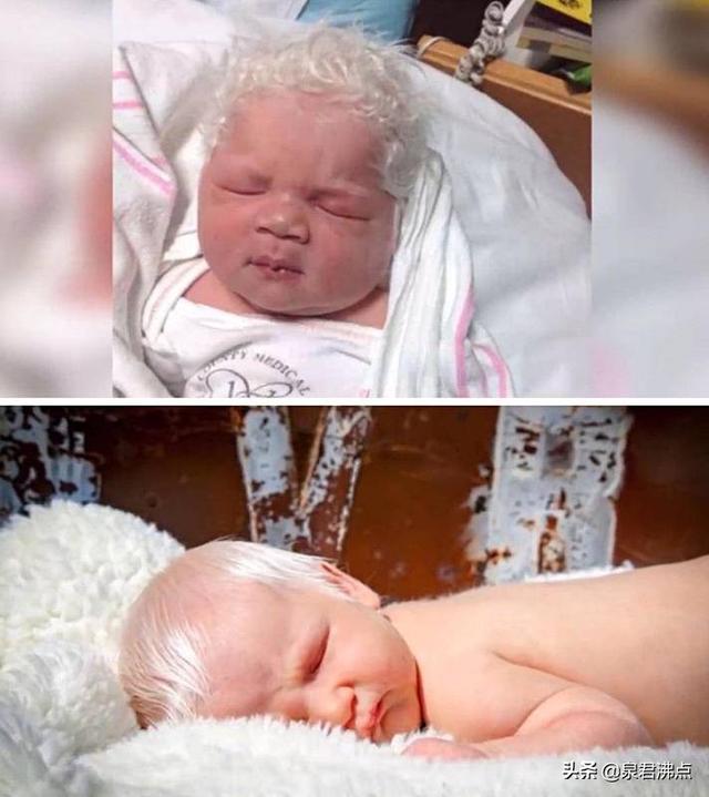                     世界上10个天生异类的孩子，智商比爱因斯坦还高！