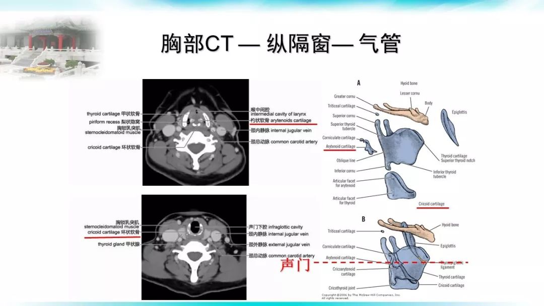 此类患者肺塌陷相对困难 断层解剖学定义杓状软骨的位置即为声门的