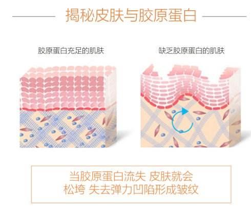 胶原蛋白肽与斑块的关系胶原蛋白肽到底是个什么鬼