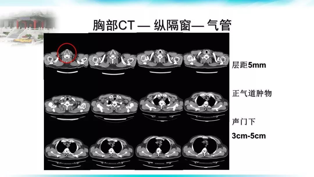 胸科麻醉实战营胸部ct读片要点与肺塌陷技术