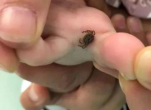                     夺命蜱虫1月内致3人死亡！宝宝身上出现这种“小黑痣”别大意