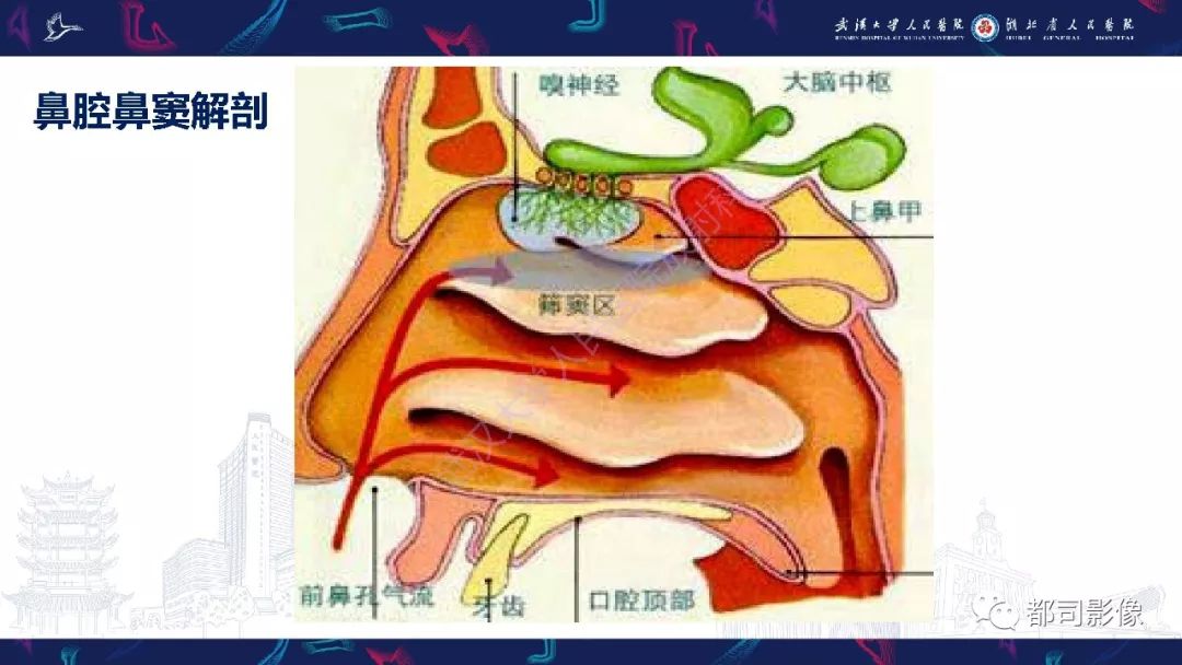 鼻腔鼻窦骨肉瘤影像诊断及鉴别诊断