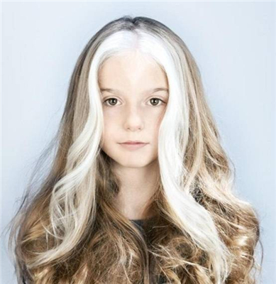 猫咪的小白爪竟然是种病?