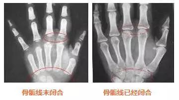                     宝宝身高能否再增高10cm，全靠身上这条线！