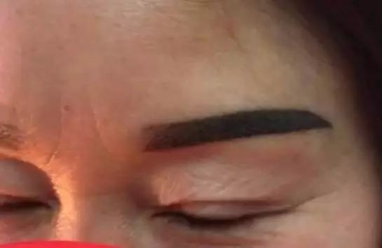 吃什么不会掉眉毛 4bba17c21aaa4cda86f5c1684e3f5dd9.jpeg