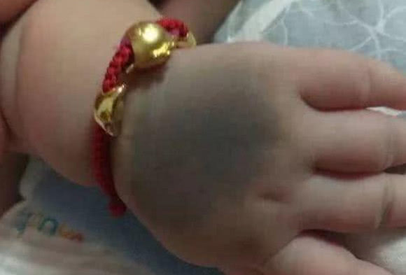                     不想宝宝有丑陋的胎记，孕期这三件事得撒手，再喜欢都得憋住