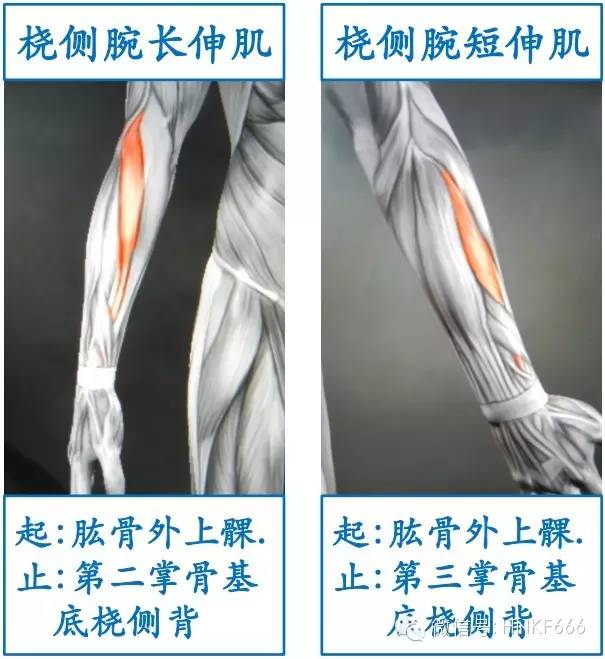 20,伸腕肌群