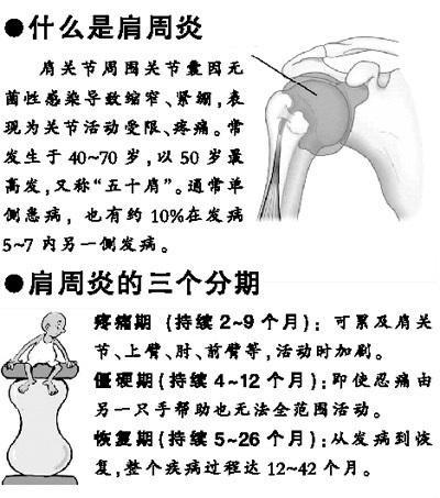 杭州骨科医院带您了解四个居家治疗肩周炎的妙招