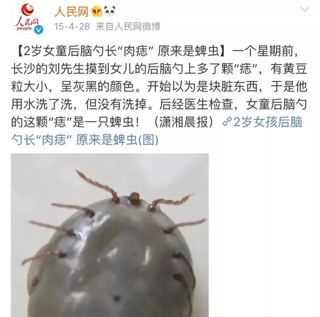                     夺命蜱虫1月内致3人死亡！宝宝身上出现这种“小黑痣”别大意