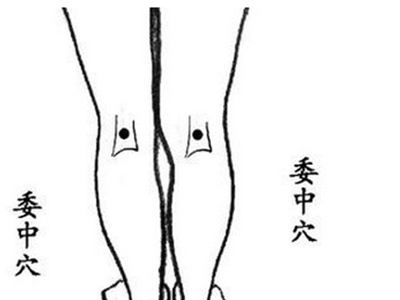 腰椎间盘突出委中取穴