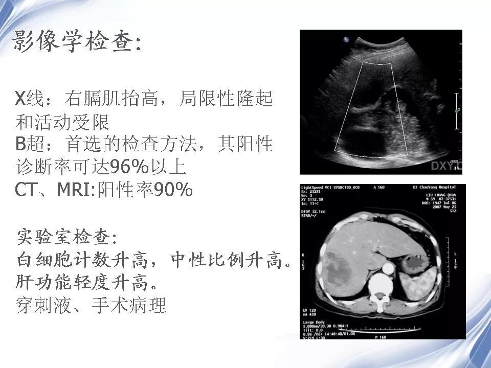 细菌性肝脓肿的影像诊断 | 影像天地