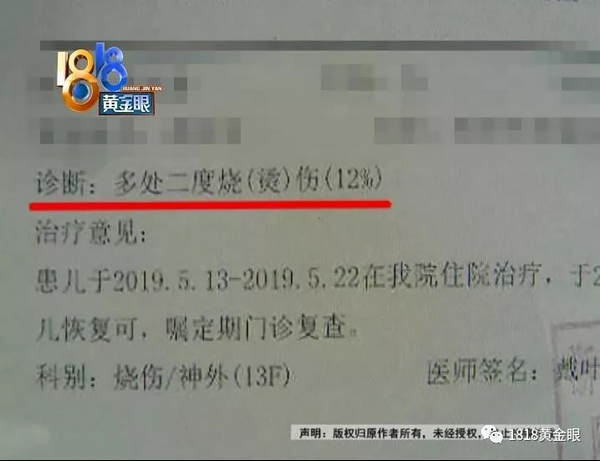                     一家人去下馆子，宝宝被水烫了，多处二度烫伤