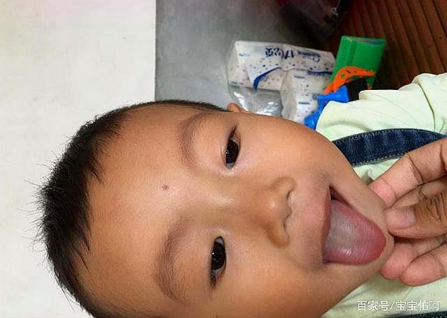                     为何现在积食的孩子越来越多？除了吃得太多，这两种积食更棘手