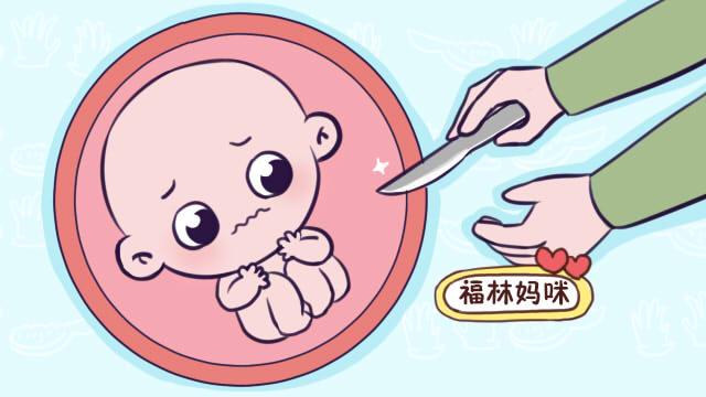                     原创            剖腹产宝宝比自然分娩宝宝更爱哭闹！是真的吗？逃不过三个原因