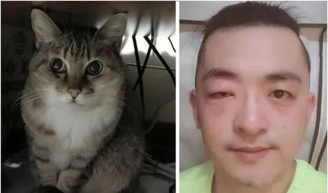 对猫严重过敏依然不离不弃,主人守护21年落泪:猫咪送的最后一次过敏!