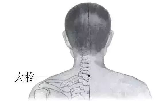 孩子发烧记住这13个立竿见影的退烧方法