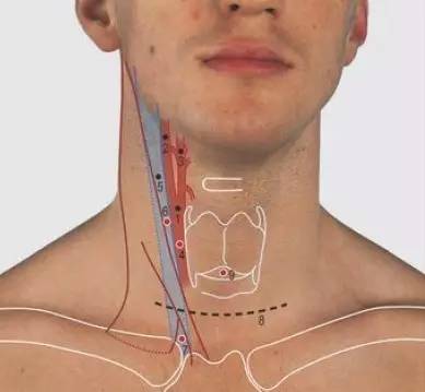 【疼痛必备】颈部的体表标志和体表投影及其临床意义-搜狐大视野-搜狐