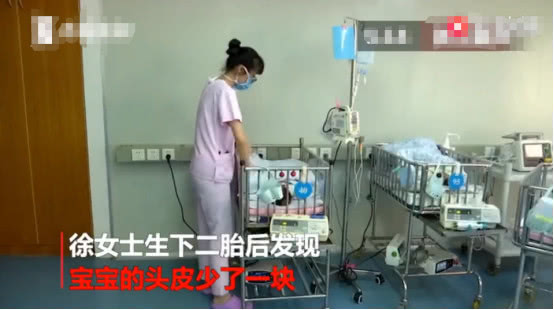                     新生儿被发现患有罕见病，天生头皮少一块，发生率仅为千万分之一