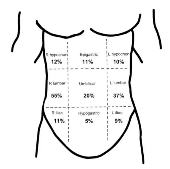 肚子上任何部位都可能岔气,但是右腹的地方发生概率为55%,最可能