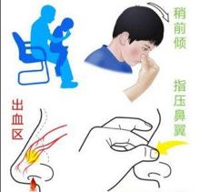                     孩子眼睛、耳朵、鼻子受伤怎么办？崔医生给出了最实用答案
