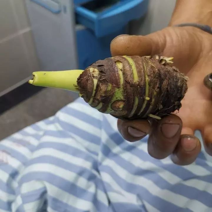 注意!碰了一下就中毒,严重者可致命!这个毒物很多人家里有 亿万先生007官方网