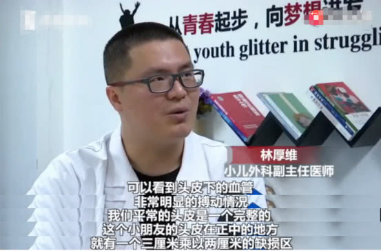                     新生儿被发现患有罕见病，天生头皮少一块，发生率仅为千万分之一