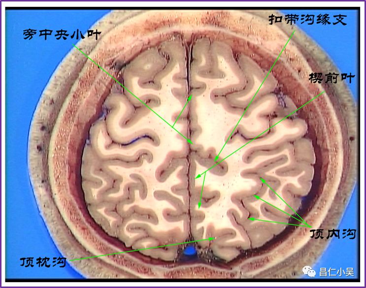 神经解剖学习笔记脑回脑沟